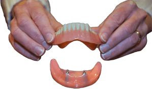 denture being placed on dental implant