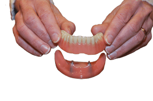 denture being placed on dental implant
