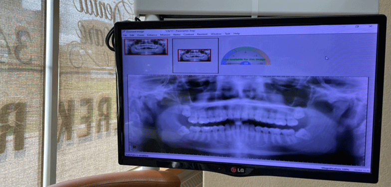 dentist showing xray to patient